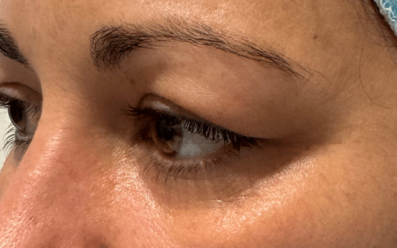 Antes