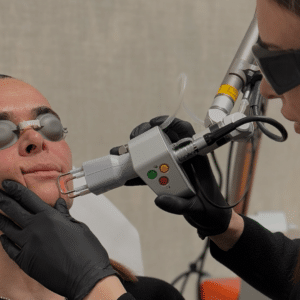 Efecto reset Laser Co2