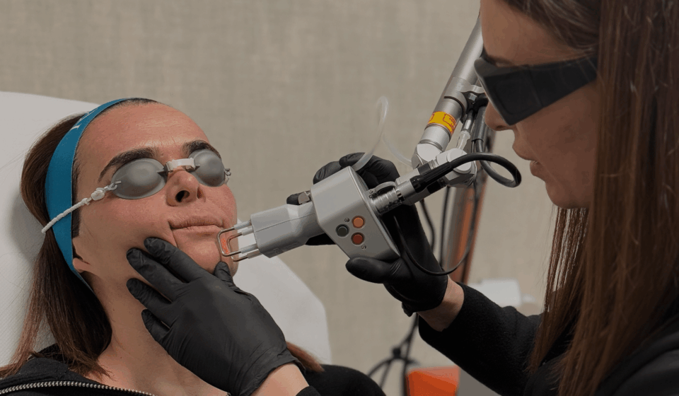 Efecto reset Laser Co2